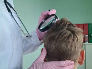 concept for hair loss consultation questions