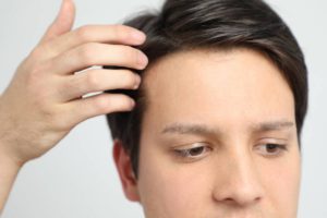 Featured image for Can Hair Grow Back Naturally After Balding?